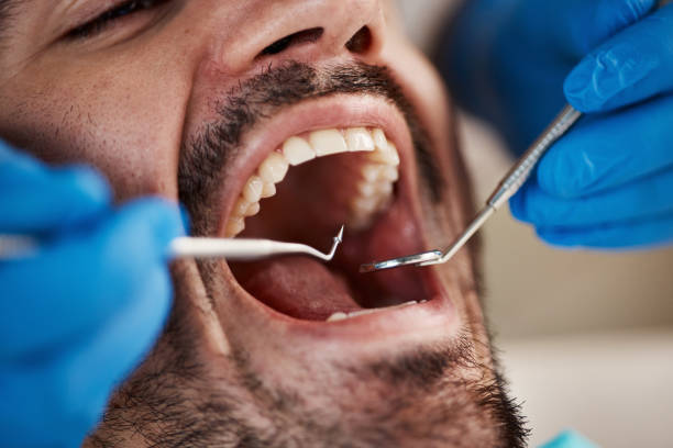 Oral Cancer Screening in Nicoma Park, OK